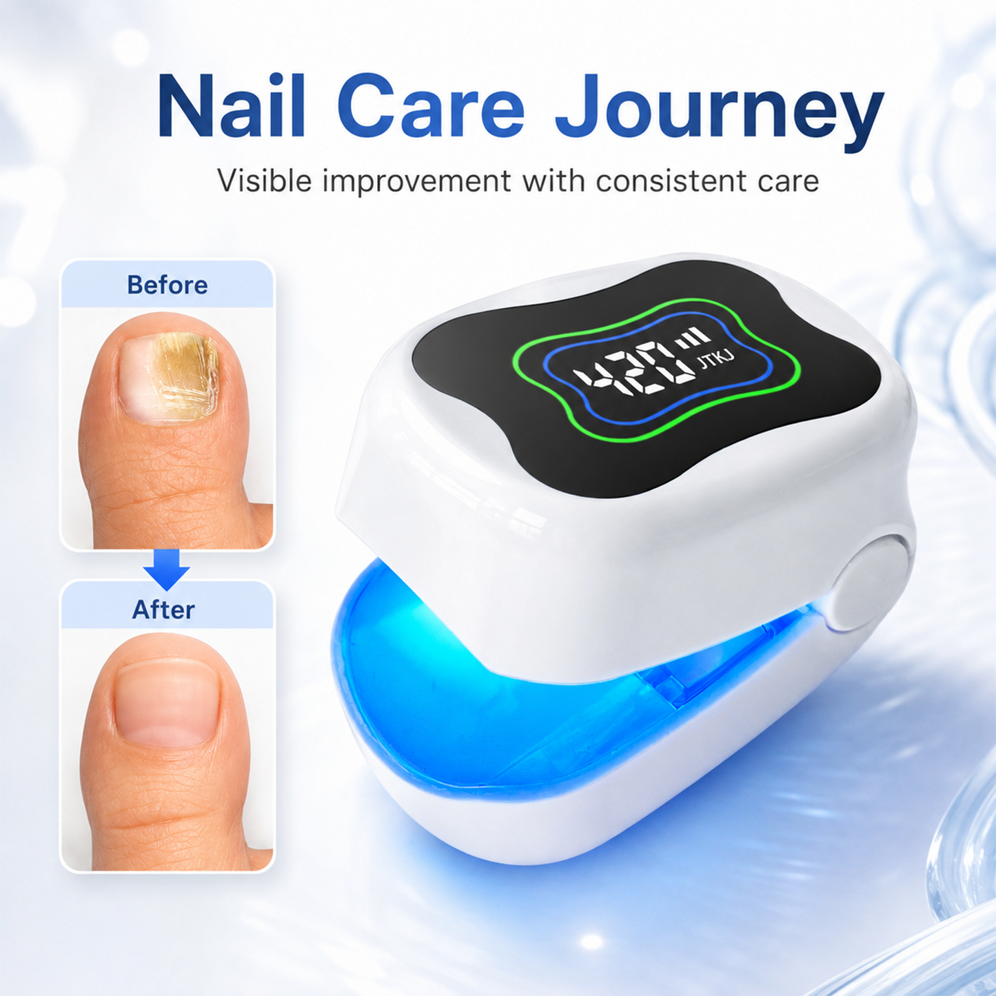 470nm Blue Light + 905nm Infrared Nail Fungus Care Device